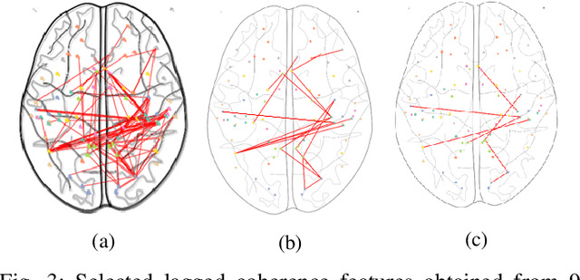 Figure 3 for Finding neural signatures for obesity using source-localized EEG features