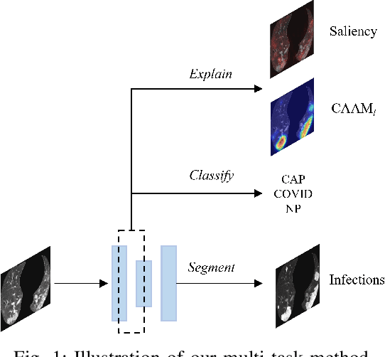 Figure 1 for Explainable COVID-19 Infections Identification and Delineation Using Calibrated Pseudo Labels