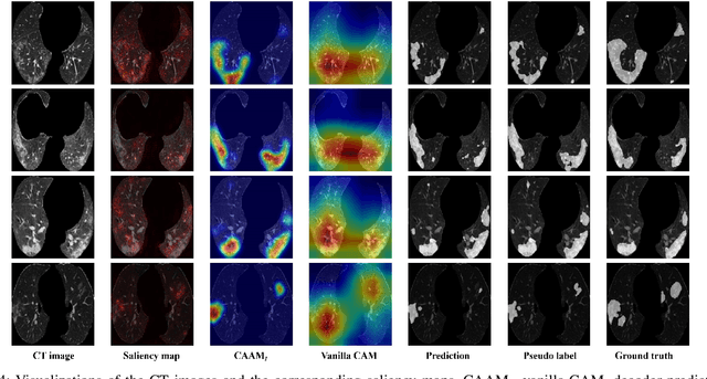 Figure 4 for Explainable COVID-19 Infections Identification and Delineation Using Calibrated Pseudo Labels