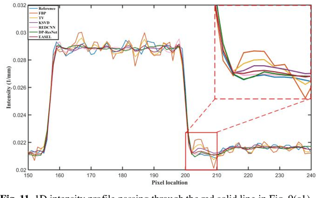 Figure 3 for Iterative Reconstruction for Low-Dose CT using Deep Gradient Priors of Generative Model