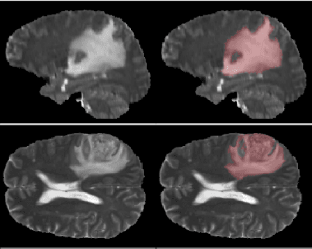 Figure 3 for Uncertainty Quantification using Variational Inference for Biomedical Image Segmentation