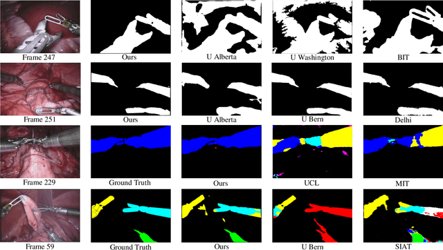 Figure 2 for ST-MTL: Spatio-Temporal Multitask Learning Model to Predict Scanpath While Tracking Instruments in Robotic Surgery