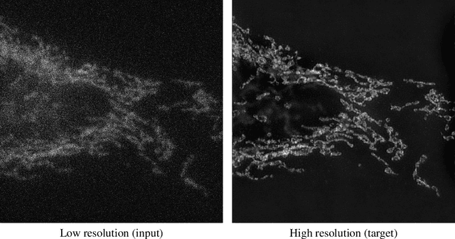 Figure 1 for Microscopy Image Restoration using Deep Learning on W2S