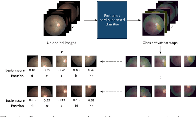 Figure 1 for Semi-weakly Supervised Contrastive Representation Learning for Retinal Fundus Images