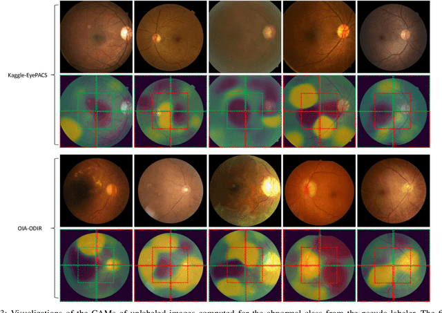 Figure 3 for Semi-weakly Supervised Contrastive Representation Learning for Retinal Fundus Images