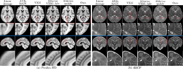 Figure 3 for Generative Adversarial Registration for Improved Conditional Deformable Templates