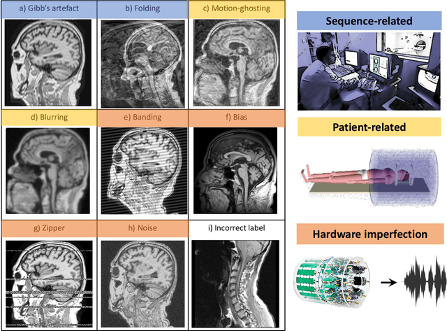 Figure 3 for An efficient semi-supervised quality control system trained using physics-based MRI-artefact generators and adversarial training