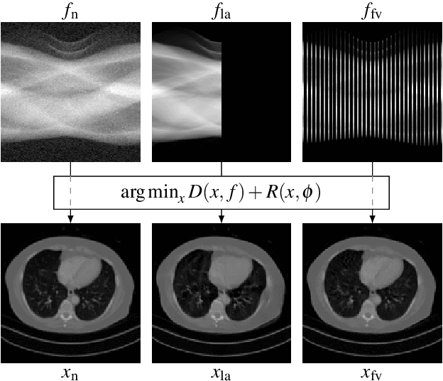 Figure 1 for Computed Tomography Reconstruction using Generative Energy-Based Priors