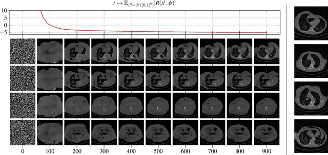 Figure 3 for Computed Tomography Reconstruction using Generative Energy-Based Priors