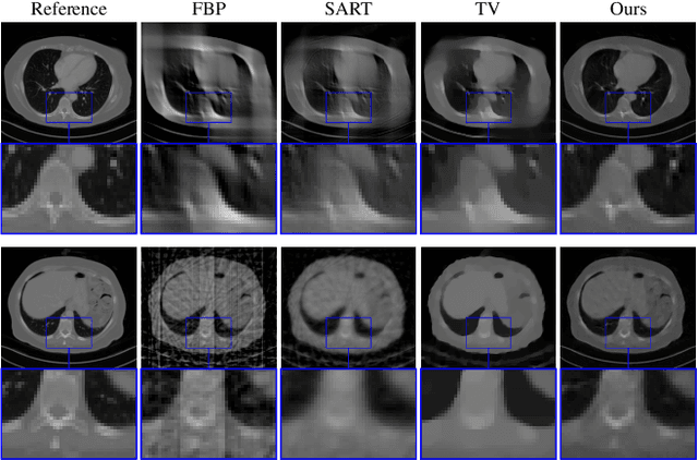 Figure 4 for Computed Tomography Reconstruction using Generative Energy-Based Priors