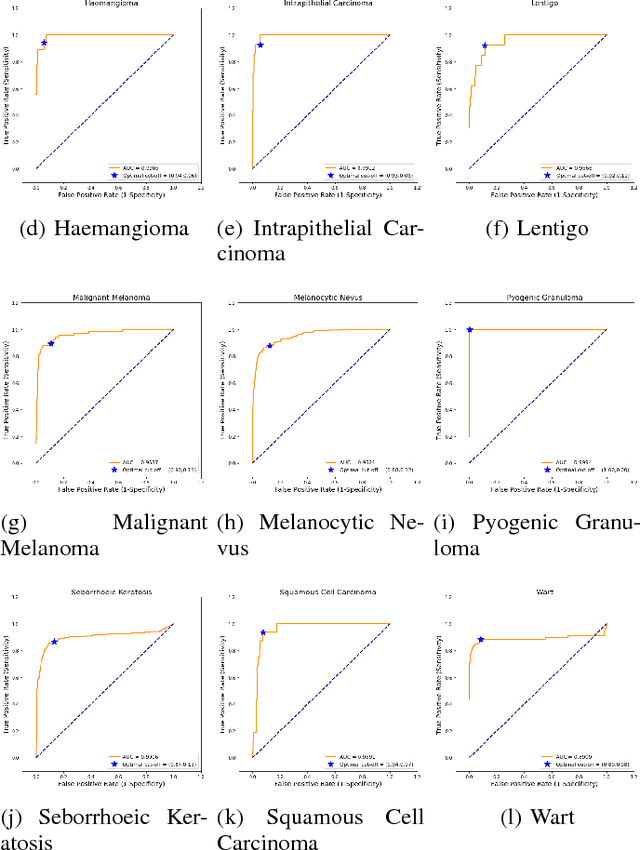 Figure 3 for Skin Lesions Classification Using Convolutional Neural Networks in Clinical Images