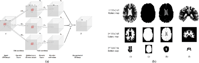 Figure 1 for Alzheimer's Disease Diagnostics by Adaptation of 3D Convolutional Network