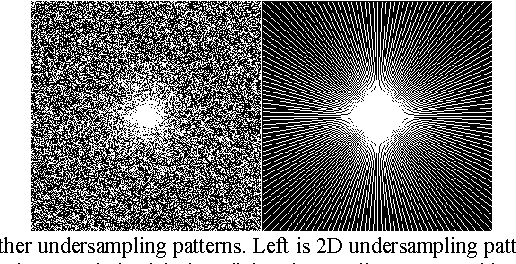 Figure 2 for Projected Iterative Soft-thresholding Algorithm for Tight Frames in Compressed Sensing Magnetic Resonance Imaging