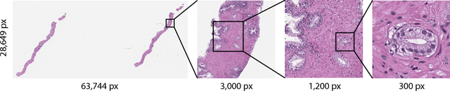 Figure 1 for Terabyte-scale Deep Multiple Instance Learning for Classification and Localization in Pathology