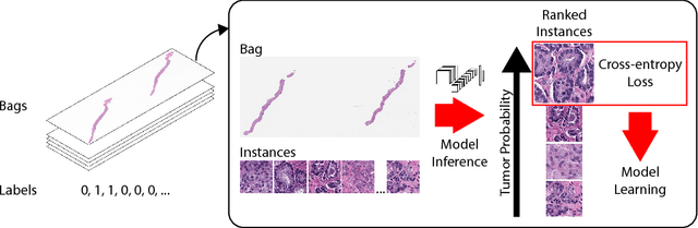 Figure 3 for Terabyte-scale Deep Multiple Instance Learning for Classification and Localization in Pathology