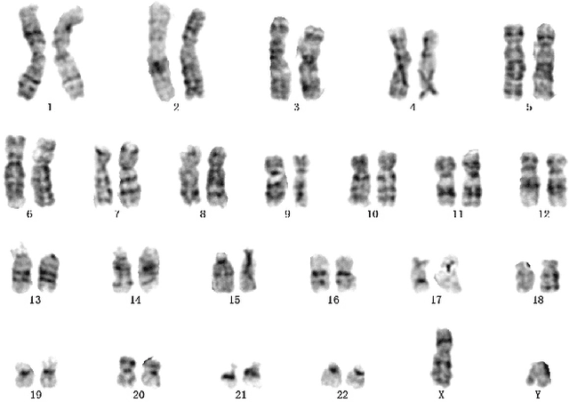 Figure 1 for A Novel Application of Image-to-Image Translation: Chromosome Straightening Framework by Learning from a Single Image