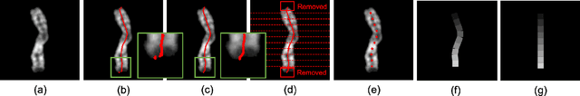 Figure 2 for A Novel Application of Image-to-Image Translation: Chromosome Straightening Framework by Learning from a Single Image