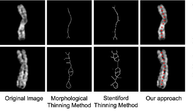 Figure 4 for A Novel Application of Image-to-Image Translation: Chromosome Straightening Framework by Learning from a Single Image