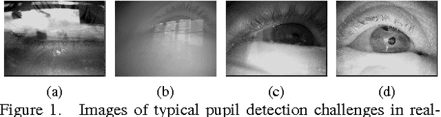 Figure 1 for PupilNet: Convolutional Neural Networks for Robust Pupil Detection