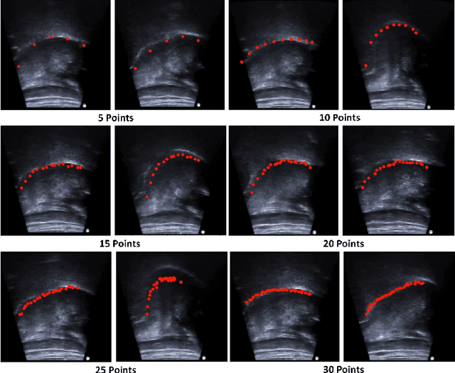 Figure 3 for Deep Learning for Automatic Tracking of Tongue Surface in Real-time Ultrasound Videos, Landmarks instead of Contours