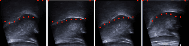Figure 4 for Deep Learning for Automatic Tracking of Tongue Surface in Real-time Ultrasound Videos, Landmarks instead of Contours