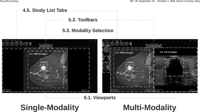 Figure 1 for BreastScreening: On the Use of Multi-Modality in Medical Imaging Diagnosis