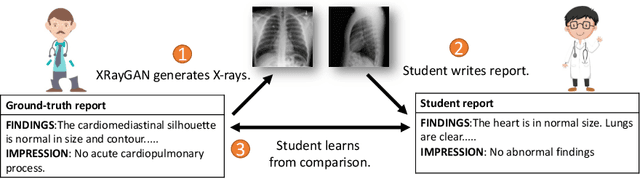 Figure 1 for XRayGAN: Consistency-preserving Generation of X-ray Images from Radiology Reports
