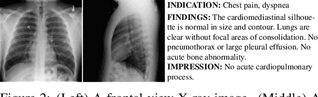 Figure 3 for XRayGAN: Consistency-preserving Generation of X-ray Images from Radiology Reports