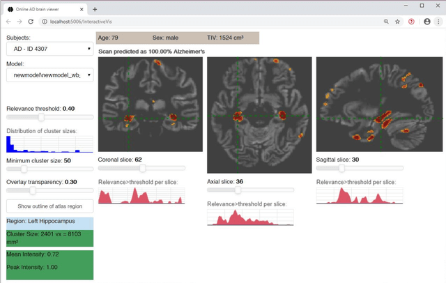 Figure 4 for Improving 3D convolutional neural network comprehensibility via interactive visualization of relevance maps: Evaluation in Alzheimer's disease