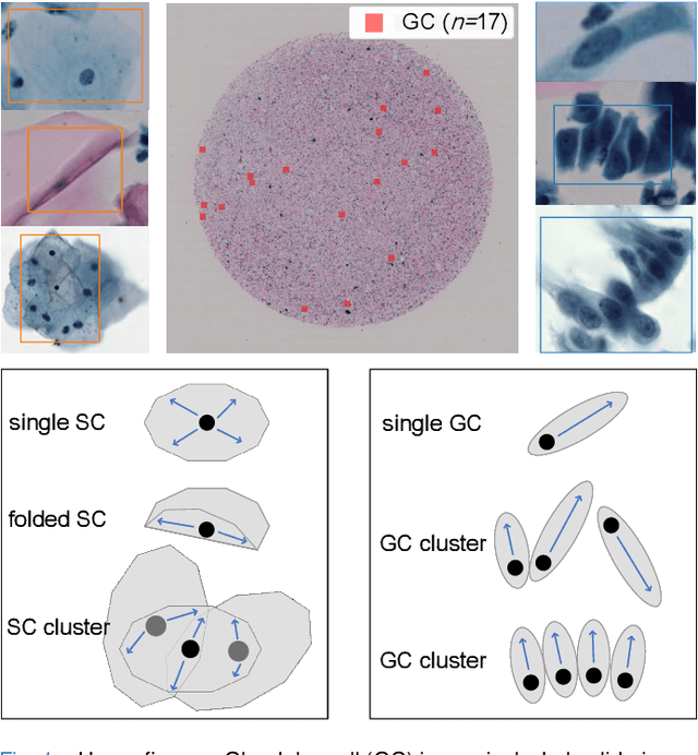 Figure 1 for Cervical Glandular Cell Detection from Whole Slide Image with Out-Of-Distribution Data