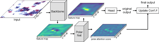 Figure 4 for Cervical Glandular Cell Detection from Whole Slide Image with Out-Of-Distribution Data