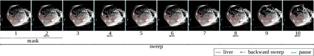 Figure 3 for Liver Segmentation using Turbolift Learning for CT and Cone-beam C-arm Perfusion Imaging