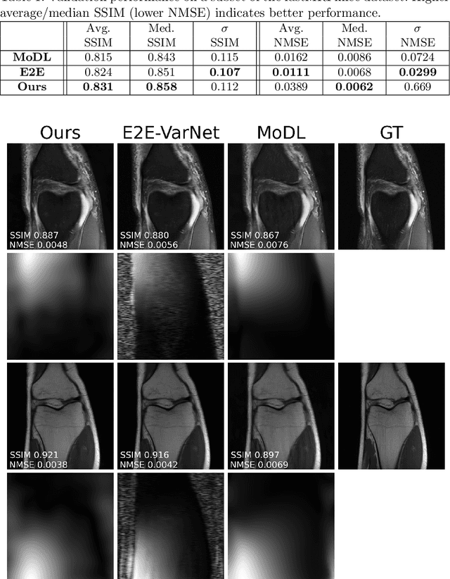 Figure 2 for Deep J-Sense: Accelerated MRI Reconstruction via Unrolled Alternating Optimization