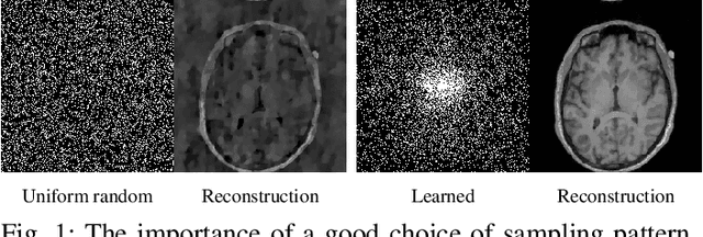 Figure 1 for Learning the Sampling Pattern for MRI