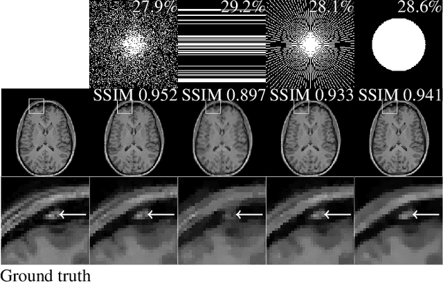 Figure 3 for Learning the Sampling Pattern for MRI