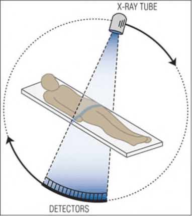 Figure 3 for CT Image Registration in Acute Stroke Monitoring