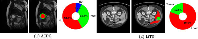 Figure 1 for Bootstrapping Semi-supervised Medical Image Segmentation with Anatomical-aware Contrastive Distillation