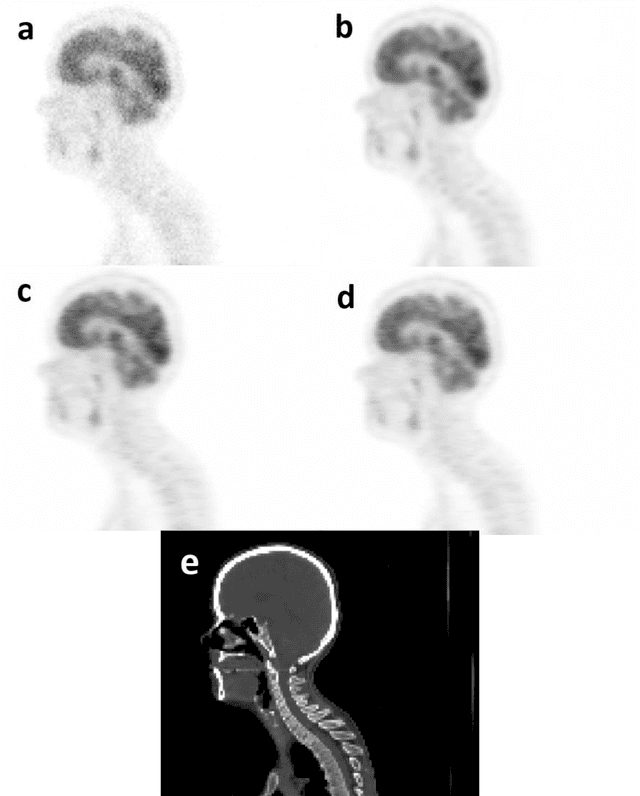 Figure 3 for Does prior knowledge in the form of multiple low-dose PET images improve standard-dose PET prediction?