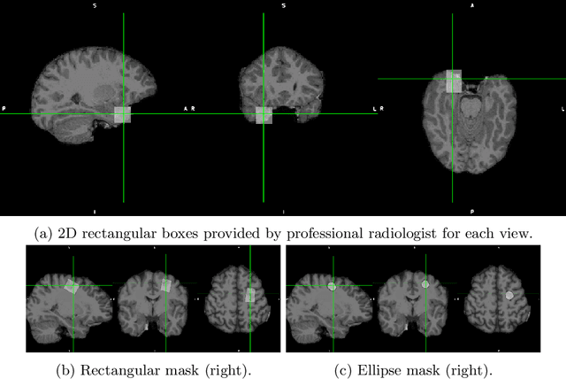 Figure 1 for Convolutional neural networks for automatic detection of Focal Cortical Dysplasia