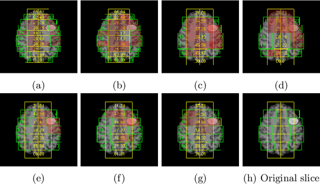 Figure 4 for Convolutional neural networks for automatic detection of Focal Cortical Dysplasia
