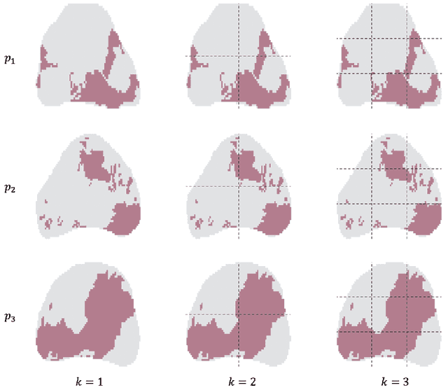 Figure 4 for Multi-resolution Super Learner for Voxel-wise Classification of Prostate Cancer Using Multi-parametric MRI