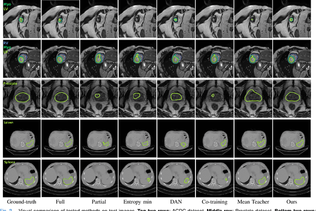 Figure 3 for Self-paced and self-consistent co-training for semi-supervised image segmentation