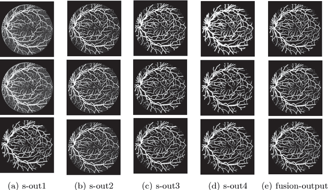 Figure 1 for Deeply supervised neural network with short connections for retinal vessel segmentation