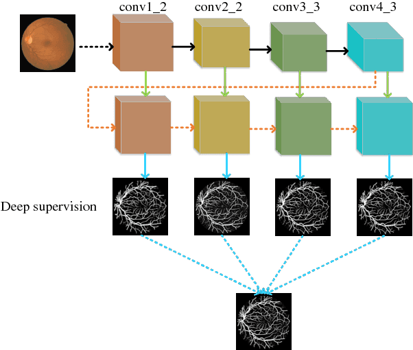 Figure 3 for Deeply supervised neural network with short connections for retinal vessel segmentation