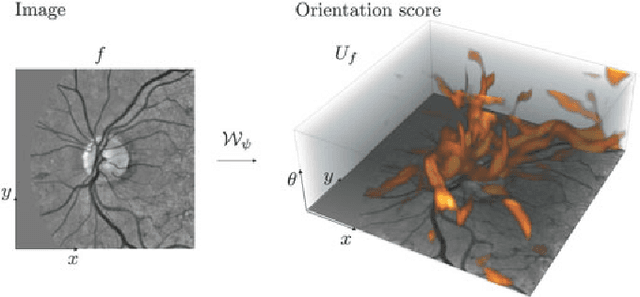 Figure 1 for Template Matching via Densities on the Roto-Translation Group