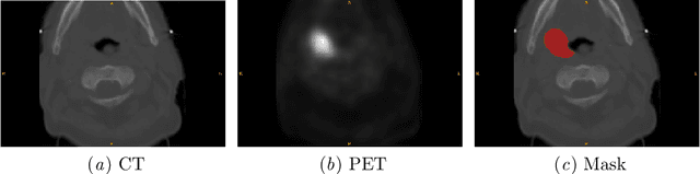 Figure 1 for Automatic Segmentation of Head and Neck Tumor: How Powerful Transformers Are?