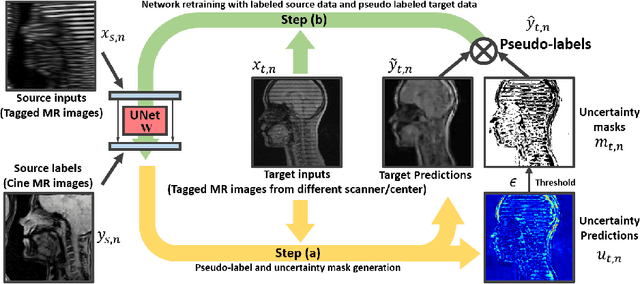 Figure 1 for Generative Self-training for Cross-domain Unsupervised Tagged-to-Cine MRI Synthesis