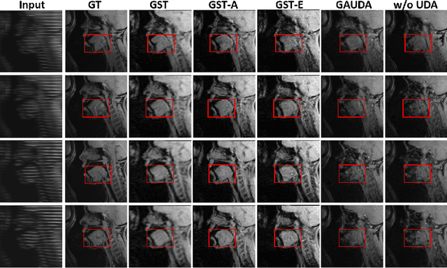 Figure 3 for Generative Self-training for Cross-domain Unsupervised Tagged-to-Cine MRI Synthesis