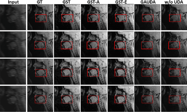 Figure 3 for Generative Self-training for Cross-domain Unsupervised Tagged-to-Cine MRI Synthesis