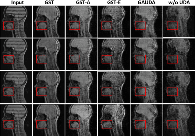 Figure 4 for Generative Self-training for Cross-domain Unsupervised Tagged-to-Cine MRI Synthesis
